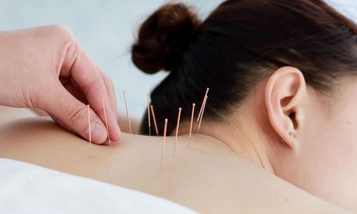 طب سوزنی در درمان فشار خون بالا