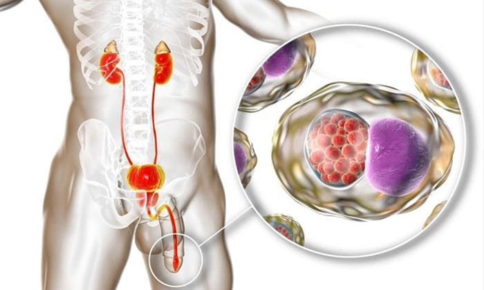 علائم کلامیدیا چیست