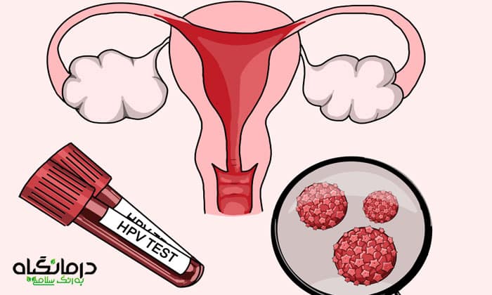 ویروس اچ پی وی چیست و راه درمان آن چگونه است