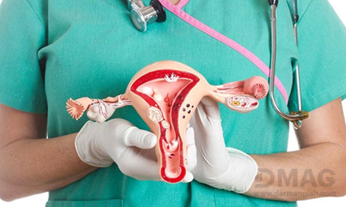 عمل هیسترکتومی برداشتن رحم