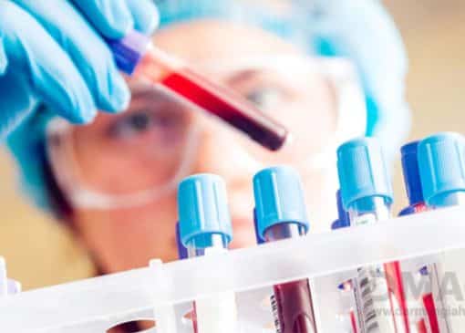 جدول تفسیر آزمایش خون