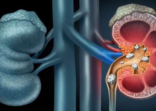 گزنه برای مو، پروستات و قند خون