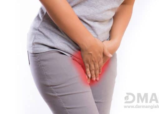 قویترین داروی ضد قارچ واژن