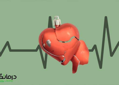 علائم سکته قلبی در زنان و مردان و فرق آن دو با هم
