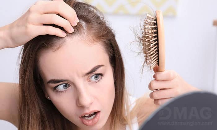 قرص پرفکتیل اورجینال برای ریزش مو خوب است؟