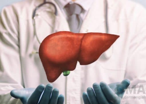 بهترین داروی گیاهی کبد چرب