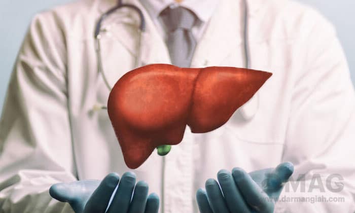 درمان کبد چرب