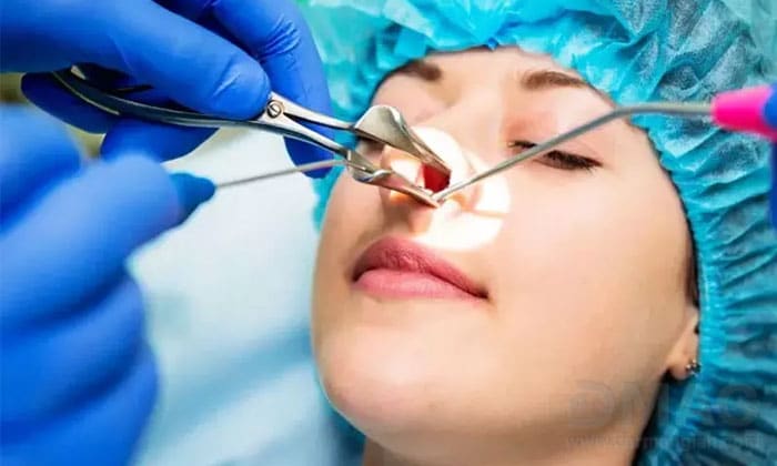 بهترین اسپری برای گرفتگی بینی