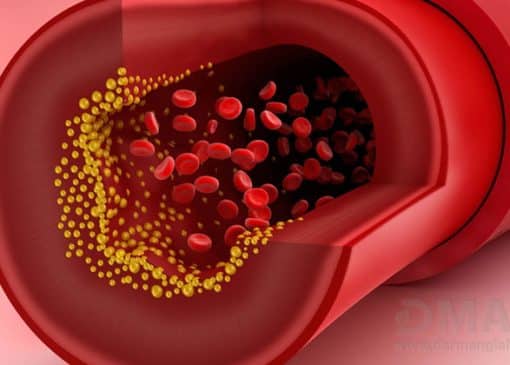 درمان تری گلیسیرید بالا در طب سنتی