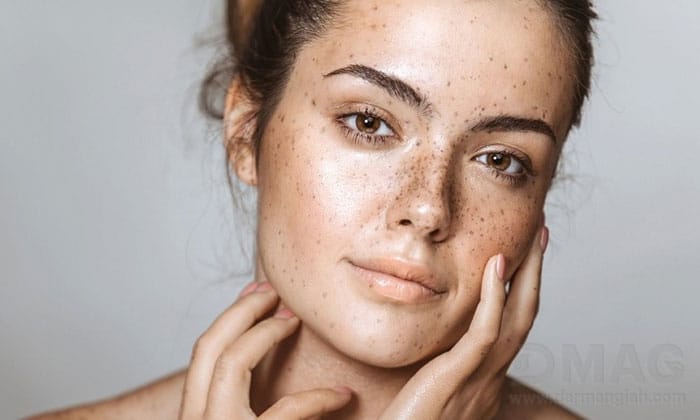 ژل کنتراکتیوبکس برای لک صورت