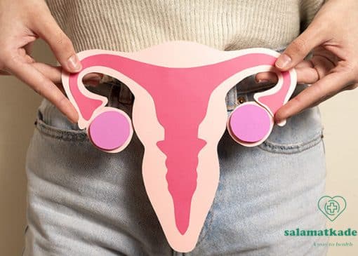 درمان تنبلی تخمدان در طب سنتی