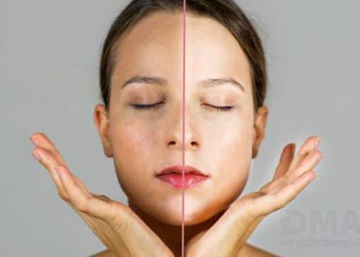 قرص روشن کننده پوست