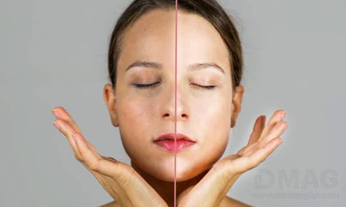 قرص روشن کننده پوست