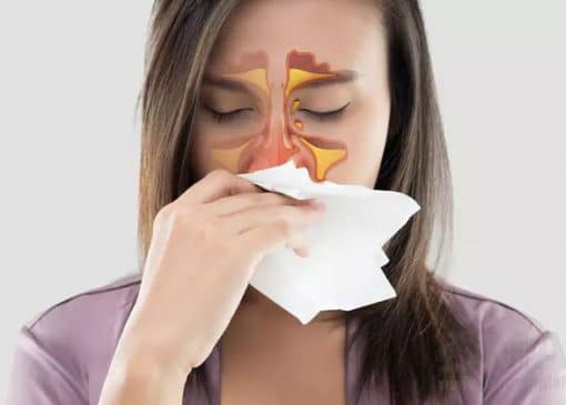 بهترین اسپری بینی برای سینوزیت