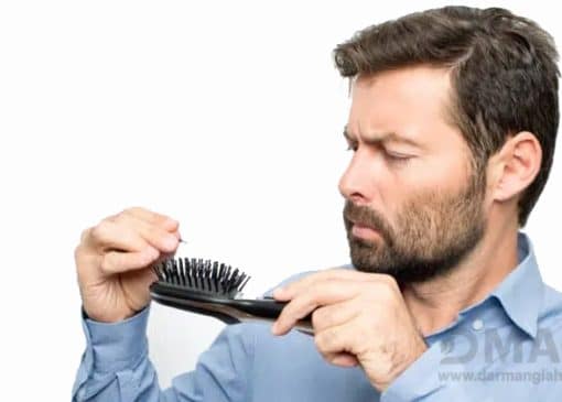 بهترین قرص ریزش مو چیست