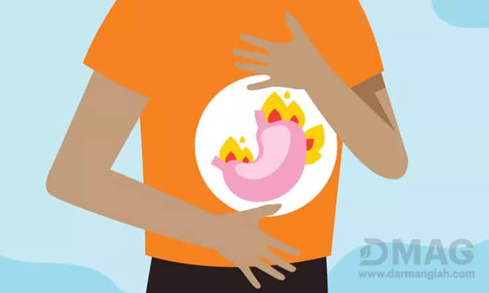 بهترین قرص برای سوزش معده