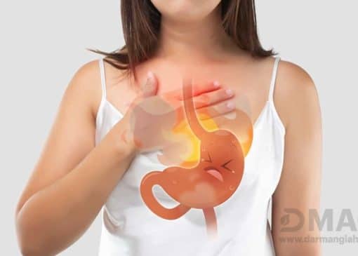 بهترین قرص برای سوزش معده