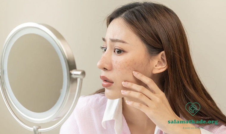 درمان کبد چرب