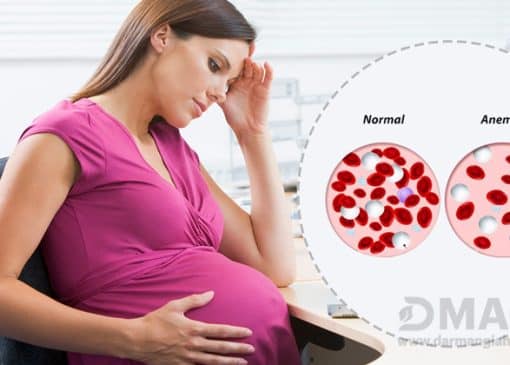 درمان کم خونی در بارداری
