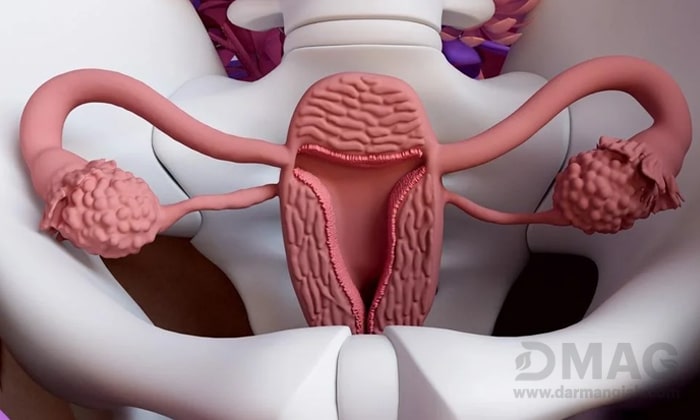 علائم سردی رحم و درمان آن