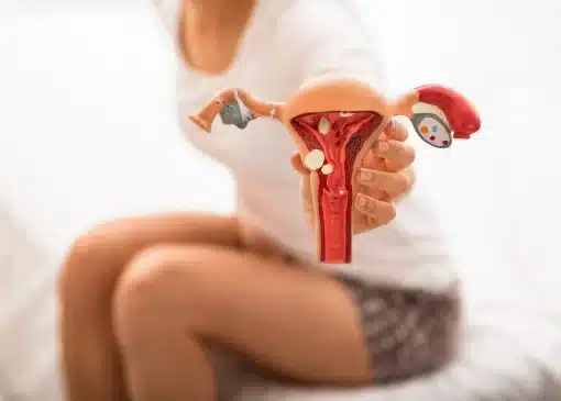 عفونت رحم (اندومتریت) چیست؟ 1 عفونت رحم