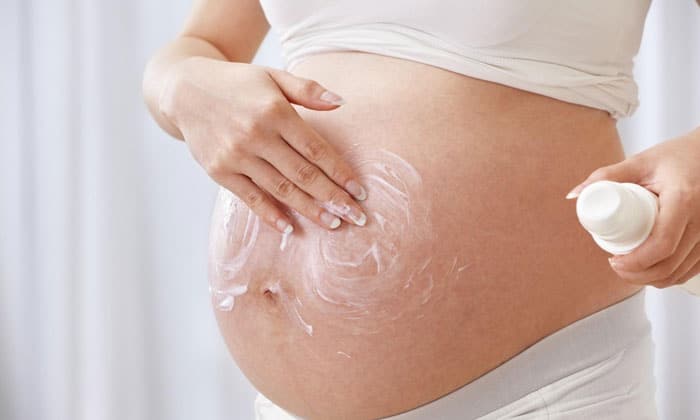 بهترین کرم ضد ترک بارداری