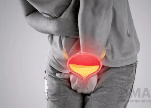 بهترین قرص شستشوی مجاری ادراری