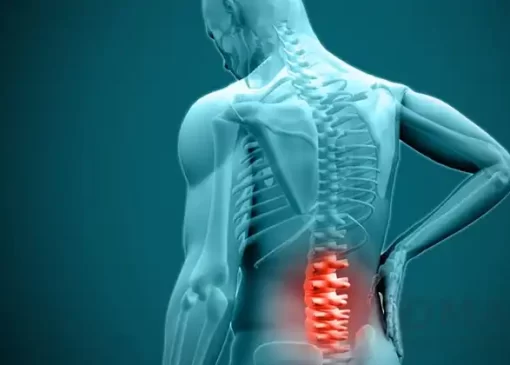 درمان دیسک کمر و درد پا با داروهای گیاهی