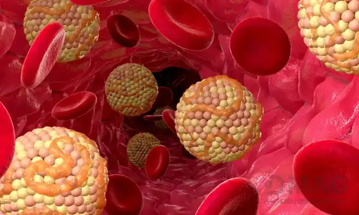 قاتل چربی خون بالا چیست