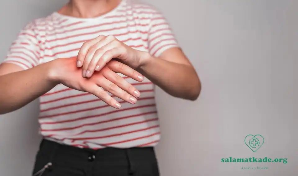 درمان سوختگی با پماد گیاهی