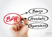 درمان بزرگی پروستات بدون جراحی