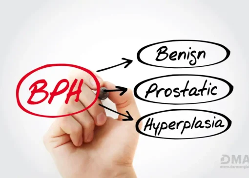 درمان بزرگی پروستات بدون جراحی