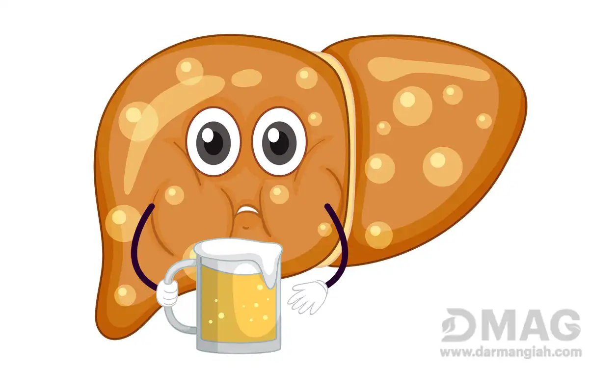 درمان سریع کبد چرب گرید 2