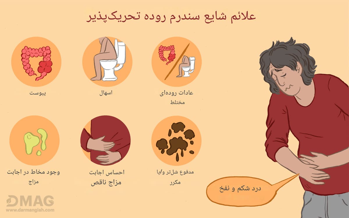 سندروم روده تحریک پذیر