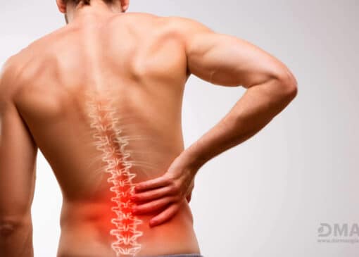 علائم سیاتیک چیست