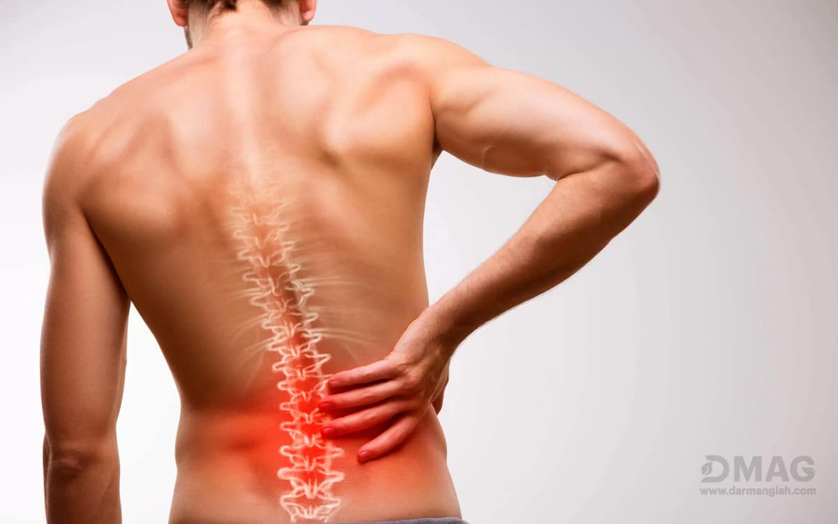 علائم سیاتیک چیست