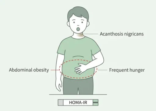 چرا مقاومت به انسولین سبب چاقی می‌شود؟