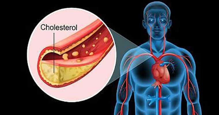 کلسترول خون