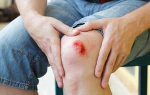 زخم و التهاب