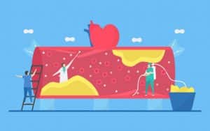 کاهش کلسترول بالا و علائم آن