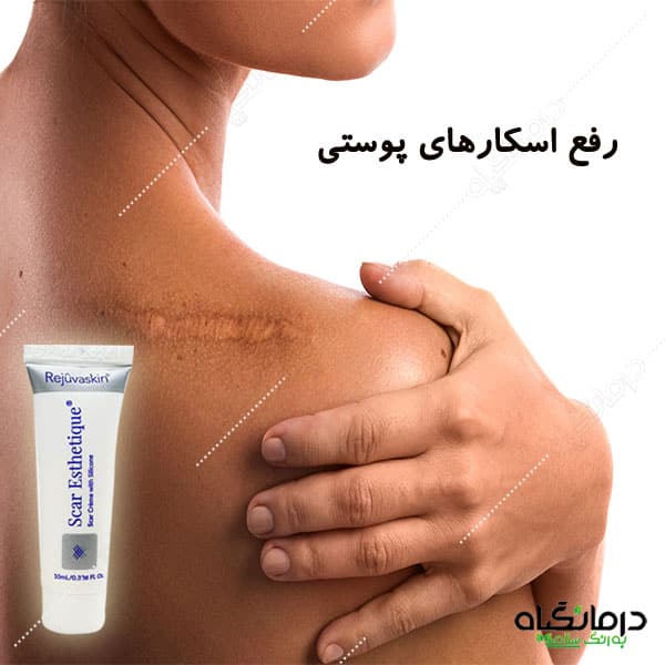 پماد اسکار استاتیک رژوا