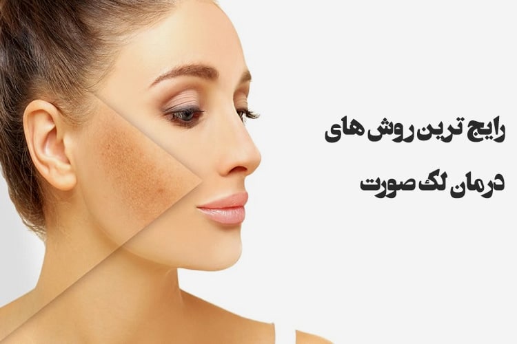 درمان لکه صورت - درمانگیاه