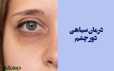 درمان سیاهی دور چشم