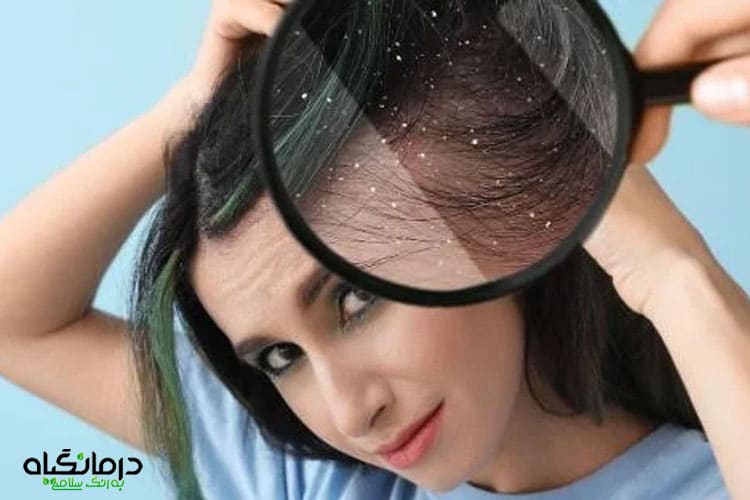 بهترین شامپو ضد شوره