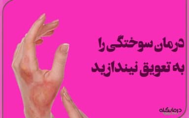 درمان سوختگی را به تعویق نیندازید