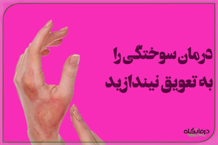 درمان سوختگی را به تعویق نیندازید