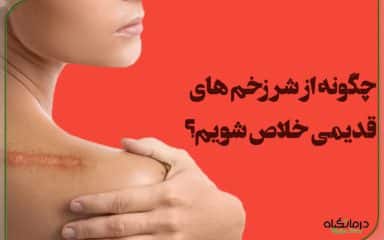 درمان اسکار بدن