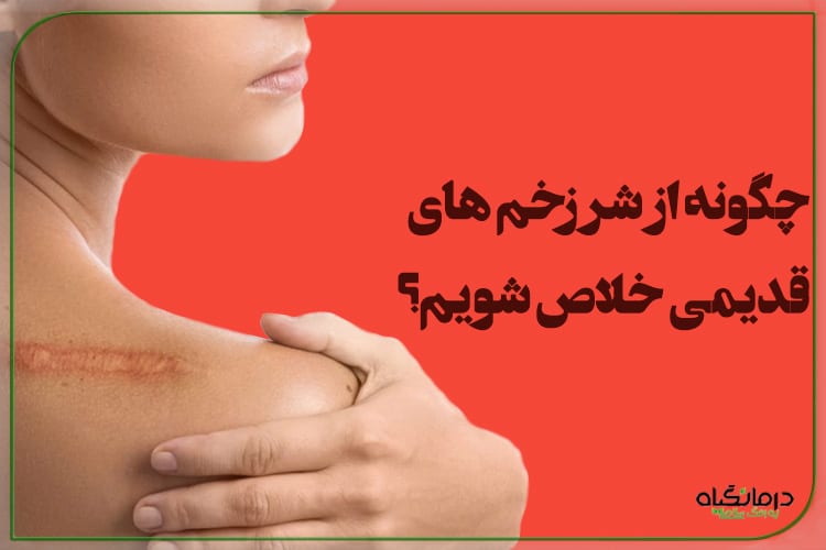 درمان اسکار بدن