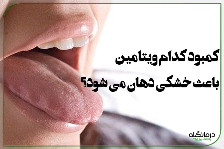 کمبود کدام ویتامین باعث خشکی دهان می شود؟