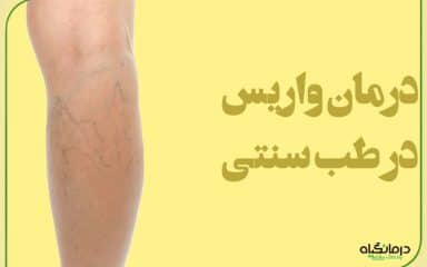 درمان واریس در طب سنتی